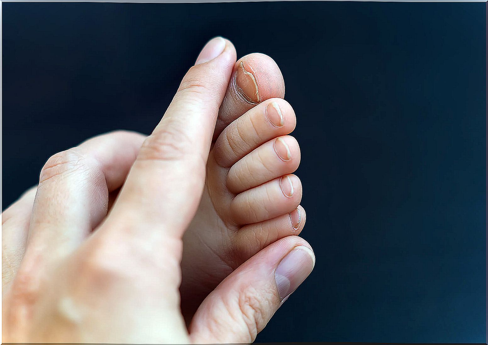 Children's nails: here's what they say about their health