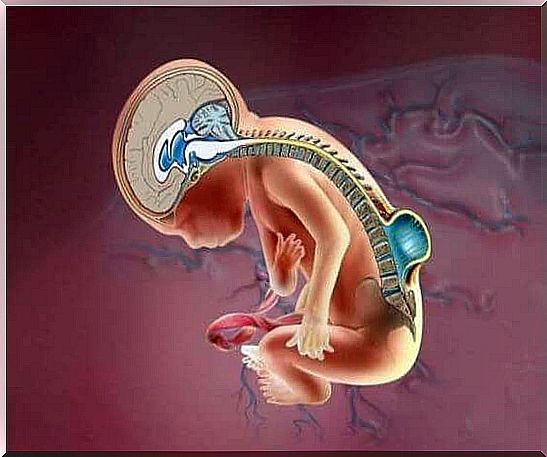 Study makes it possible to diagnose spina bifida in the fetus