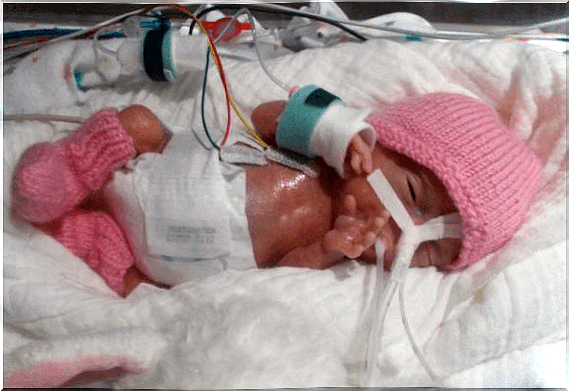 The story of Emilia, the smallest newborn in the world